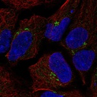 Anti-TMEM80 Antibody