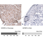 Anti-IGFBP2 Antibody