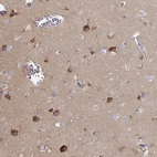 Immunohistochemical staining of human cerebral cortex shows strong granular cytoplasmic positivity in neurons.