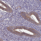 Anti-SLC9A6 Antibody