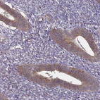 Immunohistochemical staining of human endometrium shows moderate cytoplasmic positivity in glandular cells.