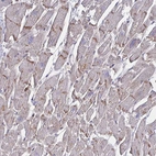 Immunohistochemical staining of human heart muscle shows moderate positivity in the intercalated discs in cardiomyocytes.