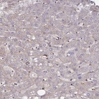 Immunohistochemical staining of human liver shows no positivity in hepatocytes as expected.