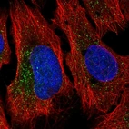 Immunofluorescent staining of human cell line U-2 OS shows localization to vesicles.