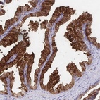 Anti-CDKL1 Antibody