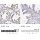 Anti-OIP5 Antibody