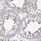 Anti-OIP5 Antibody