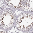 Immunohistochemical staining of human testis shows high expression.