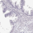 Immunohistochemical staining of human prostate shows low expression as expected.