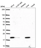 Western blot analysis in human cell line RT-4, human cell line U-251 MG, human plasma, human liver tissue and human tonsil tissue.