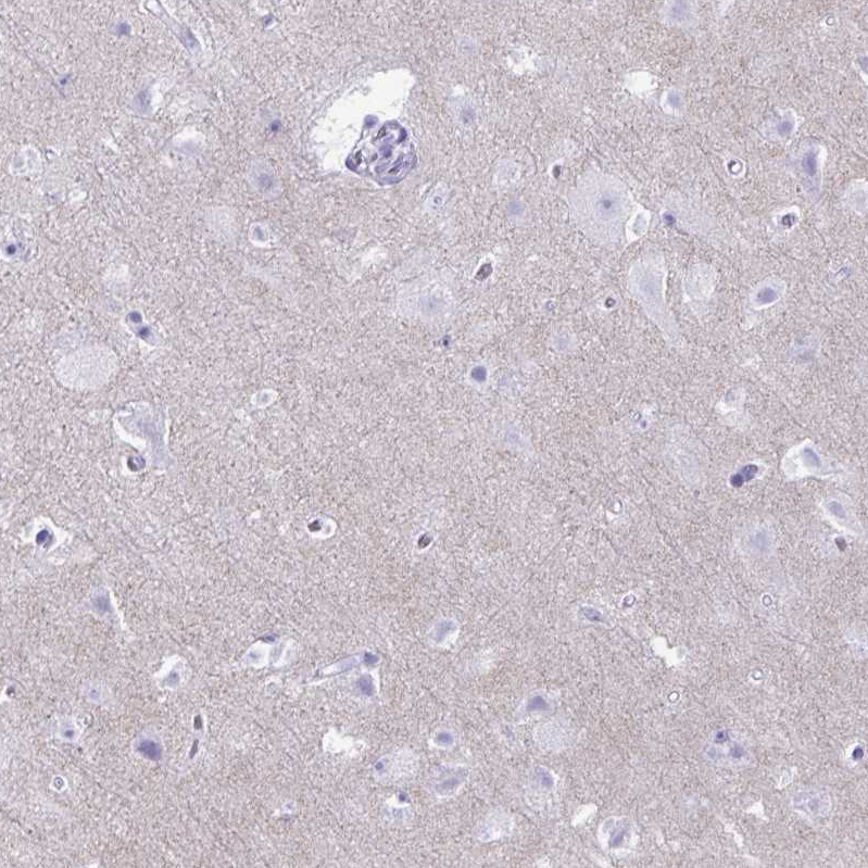 Anti-RHBDL3 Antibody