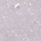 Anti-RHBDL3 Antibody