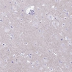 Anti-RHBDL3 Antibody