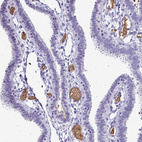Immunohistochemical staining of human fallopian tube shows strong positivity in plasma.