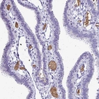 Immunohistochemical staining of human fallopian tube shows strong positivity in plasma.