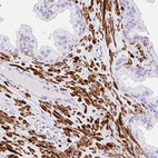 Anti-KCNN4 Antibody