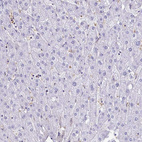 Immunohistochemical staining of human liver shows no positivity in hepatocytes as expected.