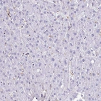 Immunohistochemical staining of human liver shows no positivity in hepatocytes as expected.