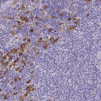 Immunohistochemical staining of human lymph node shows strong cytoplasmic positivity in a subset of non-germinal center cells.