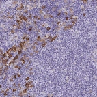 Immunohistochemical staining of human lymph node shows strong cytoplasmic positivity in a subset of non-germinal center cells.