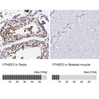 Anti-YTHDF2 Antibody