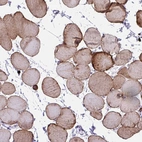 Immunohistochemical staining of human skeletal muscle shows strong cytoplasmic positivity in myocytes.