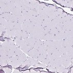 Immunohistochemical staining of human skeletal muscle shows no positivity in myocytes as expected.