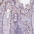 Immunohistochemical staining of human rectum shows strong cytoplasmic positivity in a subset of lymphoid cells.