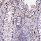 Immunohistochemical staining of human rectum shows strong cytoplasmic positivity in a subset of lymphoid cells.