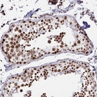 Immunohistochemical staining of human testis shows moderate to strong nuclear positivity in cells in seminiferous ducts.