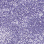 Anti-KCNN4 Antibody