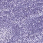 Immunohistochemical staining of human lymph node shows no positivity in non-germinal center cells as expected.