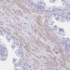 Immunohistochemical staining of human prostate shows moderate cytoplasmic positivity in smooth muscle cells.