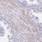 Immunohistochemical staining of human prostate shows moderate cytoplasmic positivity in smooth muscle cells.