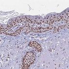 Anti-YTHDF2 Antibody