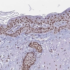 Immunohistochemical staining of human skin shows moderate to strong nuclear positivity in epidermal cells.