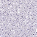 Immunohistochemical staining of human liver shows no positivity in hepatocytes as expected.