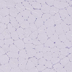Immunohistochemical staining of human skeletal muscle shows no positivity in myocytes as expected.