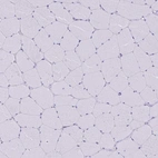 Immunohistochemical staining of human skeletal muscle shows no positivity in myocytes as expected.