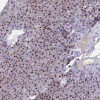 Anti-YTHDF2 Antibody