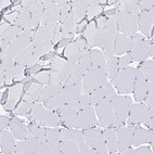 Immunohistochemical staining of human skeletal muscle shows weak to moderate positivity in myocytes.