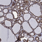 Immunohistochemical staining of human thyroid gland shows strong cytoplasmic positivity in glandular cells.