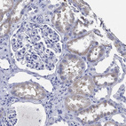 Anti-IYD Antibody