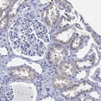 Immunohistochemical staining of human kidney shows moderate cytoplasmic positivity in cells in tubules.