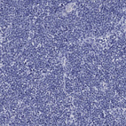 Anti-IYD Antibody