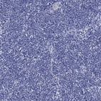 Immunohistochemical staining of human lymph node shows no positivity in non-germinal center cells as expected.