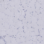 Immunohistochemical staining of human skeletal muscle shows no positivity in myocytes as expected.