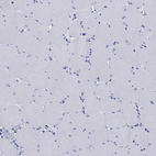 Anti-IYD Antibody