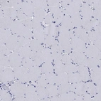 Immunohistochemical staining of human skeletal muscle shows no positivity in myocytes as expected.