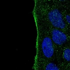 Immunofluorescent staining of human cell line CACO-2 shows localization to plasma membrane.